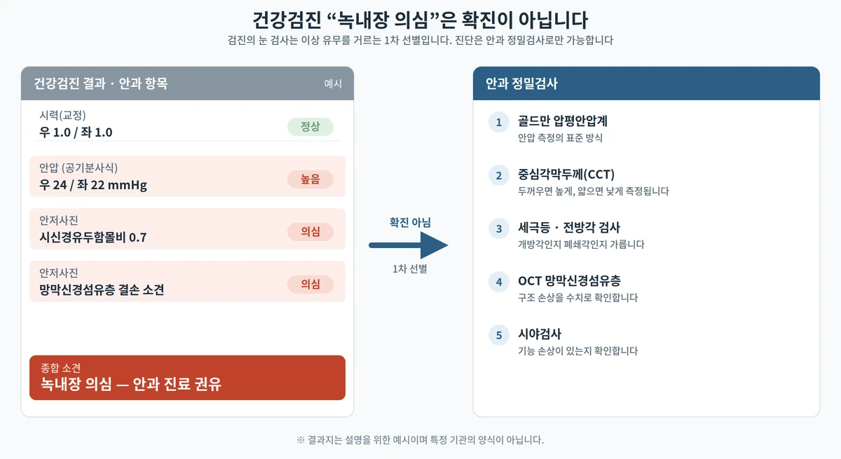 건강검진 안과 항목 결과지 예시에서 안압·시신경유두함몰비·망막신경섬유층 소견이 표시되고, 확진이 아니라 안과 정밀검사 5종으로 이어진다는 것을 나타낸 도해