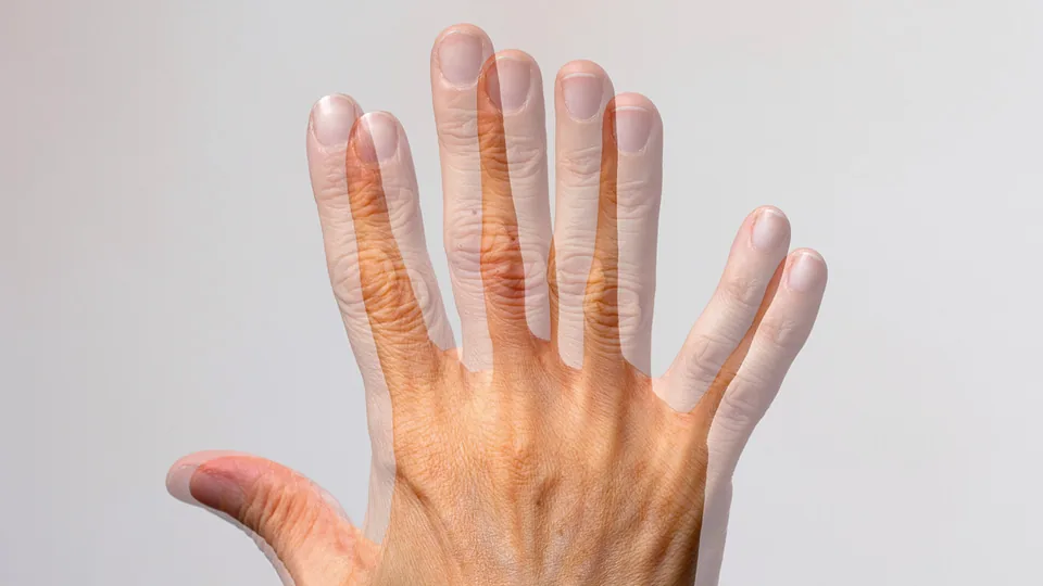 물체가 둘로 보이는 복시 증상을 표현한 이미지