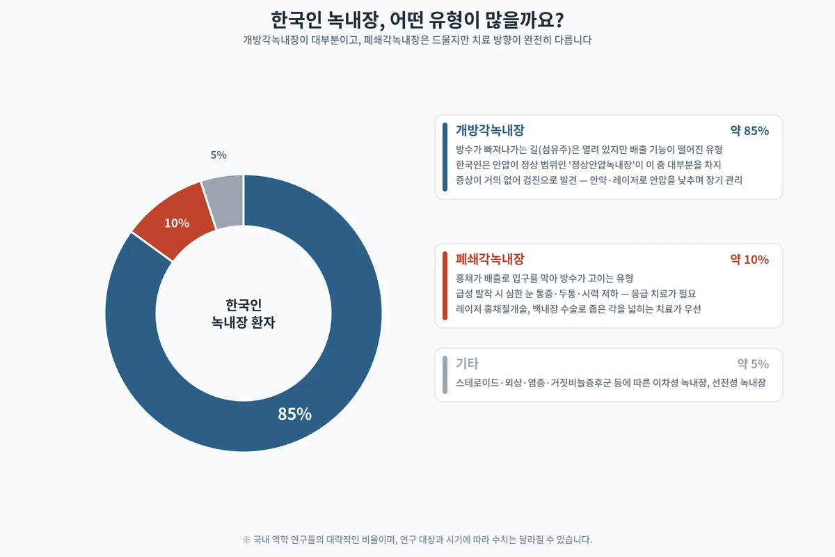 한국인 녹내장 환자의 유형 분포 도넛 그래프 — 개방각녹내장 약 85%, 폐쇄각녹내장 약 10%, 기타 약 5%